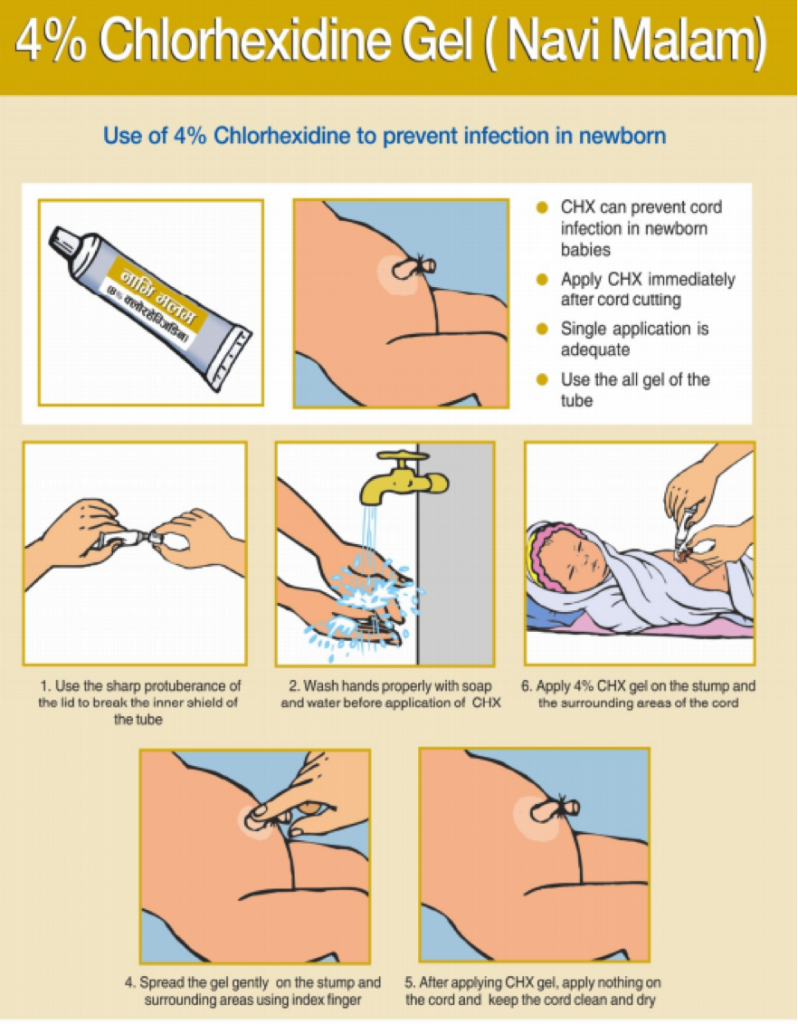 Source: Healthy Newborn Networks – Nepal CHX Training Manual 
